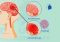 Featured image for The Burden of Choice: Simplifying Decisions in Physiotherapy Treatment