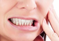 Featured image for Grinding Gears: Overcoming Bruxism and Protecting Your Teeth