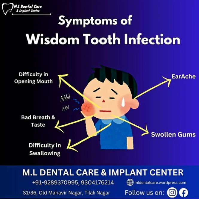 Featured image for Wisdom Tooth Woes: Navigating Impaction and Extraction