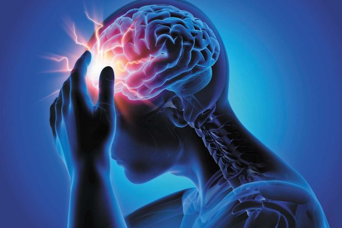 Featured image for Headache Helpers: Distinguishing Types and Finding Relief