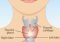 Featured image for Thyroid Troubles: Recognizing Symptoms and Seeking Proper Care