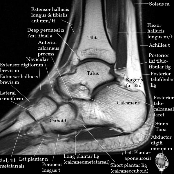 Featured image for Ankle Sprains and Strains: Effective Recovery Strategies